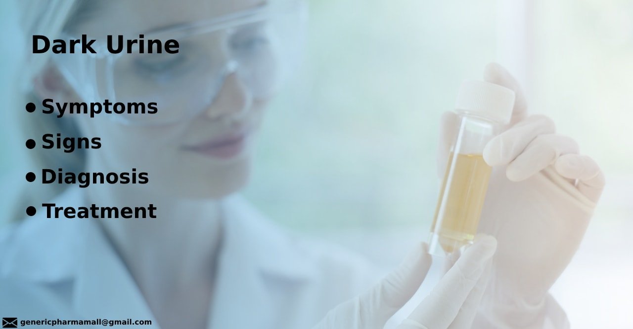 Dark Urine Symptoms Signs Diagnosis Treatment